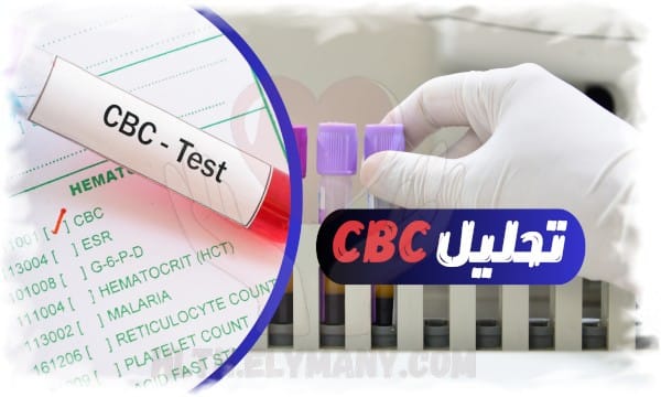 تحليل CBC يحتوي علي 5 اسرار للكشف عن اخطر الامراض