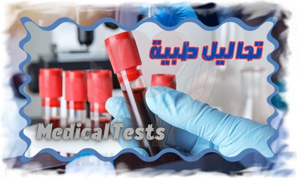 تحاليل طبية Medical Tests صحة وحياة