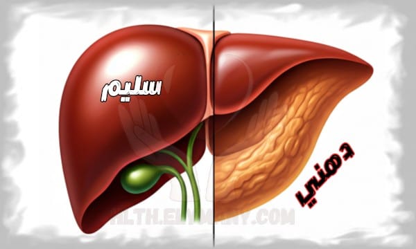 الكبد أهم عضو يدير وظائف الجسم ونصائح لتحسين صحته