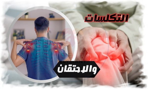 التكلسات والاحتقان العدو الخفي لصحة الإنسان