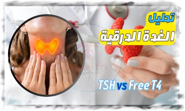 تحليل الغدة الدرقية TSH vs Free T4: الفرق وأهميتهما في التشخيص الطبي